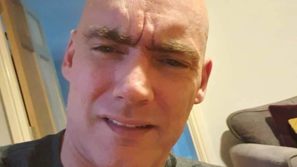 man looking confused